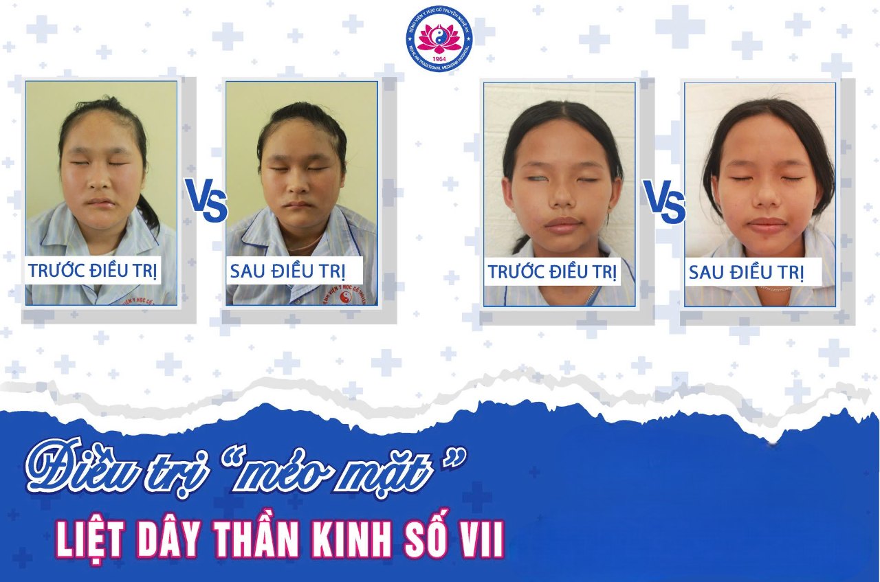 Media.NewsItem.ImageAlternateTextFormat