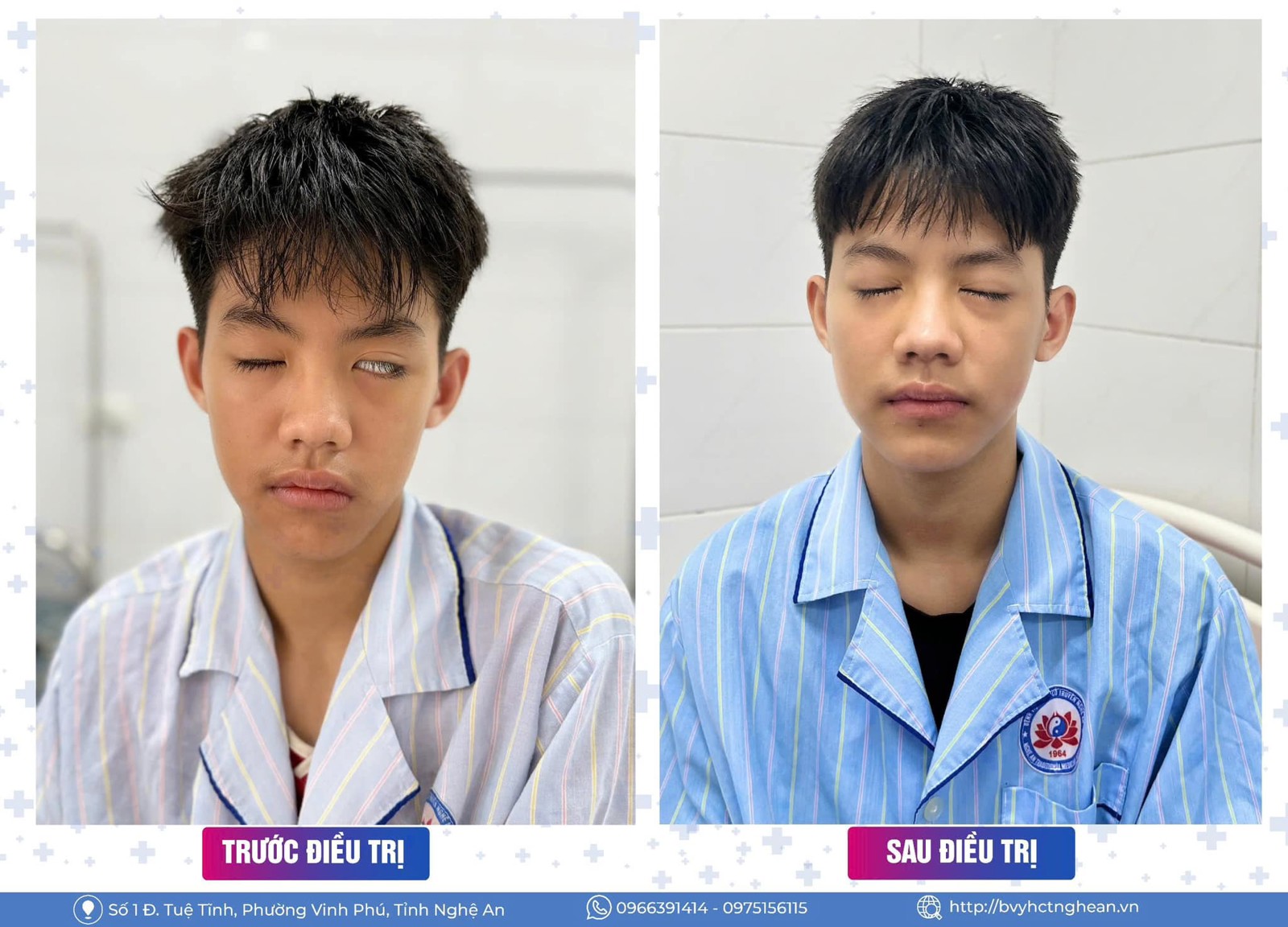 Media.NewsItem.ImageAlternateTextFormat